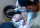 Finding Professional Help for Chicago Hair Restoration