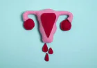 Vaginal Bleeding Between Periods: Causes, Home Care & When to Worry