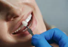 Dental Implants in Kinston, NC: Everything You Need to Know Before Replacing Missing Teeth