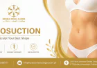 Feel Your Best with Liposuction in Islamabad