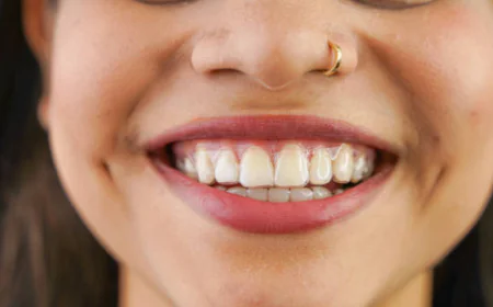 Why More People Are Choosing Teeth Aligners in Pakistan for a Straighter Smile