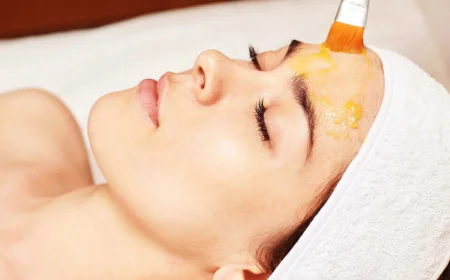 Chemical peels for treating acne-prone skin