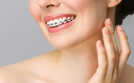 What Is the Procedure of Orthodontic Braces Treatment? Step-by-Step Guide