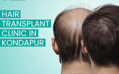 Why More People in Hyderabad Are Choosing Hair Transplant in Kondapur