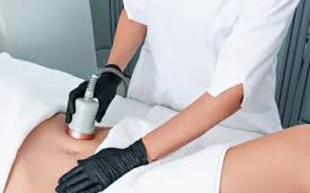 Who Is a Good Candidate for Laser Fat Reduction?