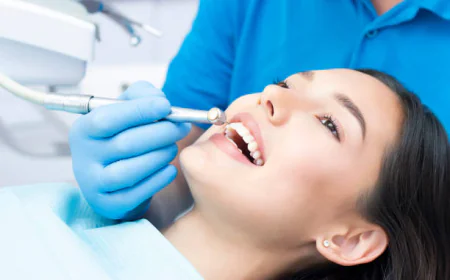 Why Teeth Scaling and Polishing Is Essential for a Healthier Smile in Islamabad