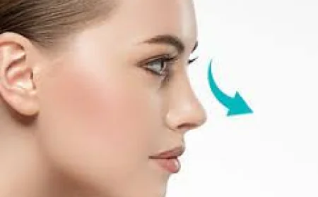 A Complete Guide to Rhinoplasty in Dubai for First-Time Patients