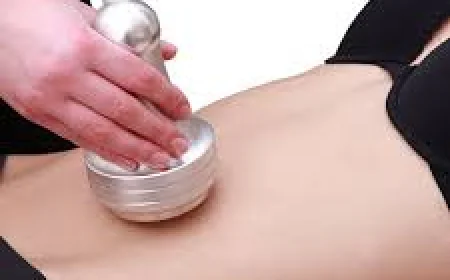 What Makes Liposuction Surgery in Dubai a Leading Cosmetic Procedure