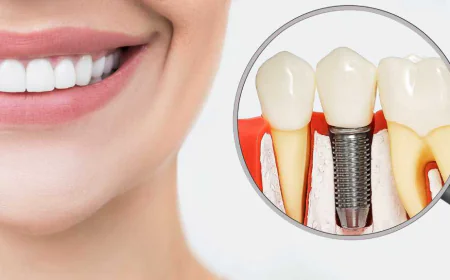 My Life After Teeth Replacement – A Complete Smile Transformation Story