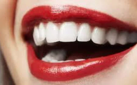 How Does Hollywood Smile Design Work?