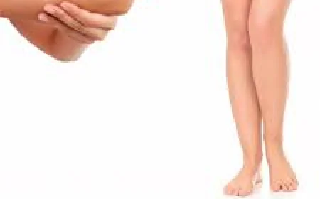 Why Leg Peel in Dubai Is Becoming a Popular Skincare Choice