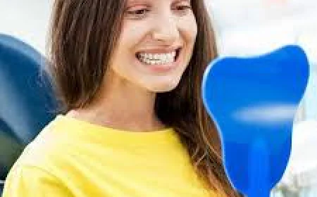 How Treatment of Fractured Teeth in Dubai Restores Your Smile and Oral Health