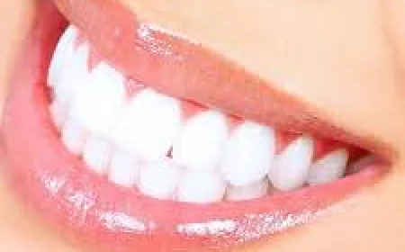 Zoom Teeth Whitening in Dubai – Complete Guide to a Brighter Smile