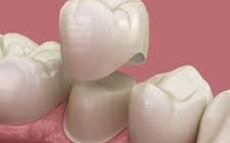 Zirconia Crowns in Dubai for a Natural-Looking Smile Transformation
