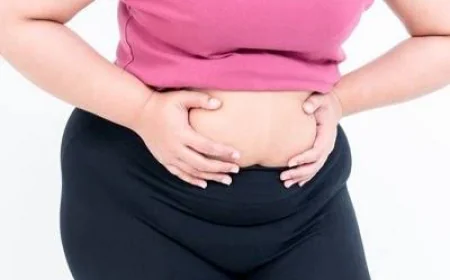 Gastric Bypass in Dubai: Everything You Need to Know Before Surgery