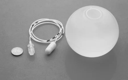 Who Is a Good Candidate for the Allurion Balloon?
