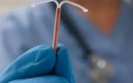 Contraceptive Implants in Dubai: Everything You Need to Know About This Long-Term Birth Control Option