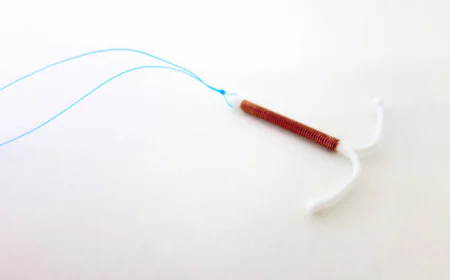 Does IUD for Contraception Require Regular Maintenance