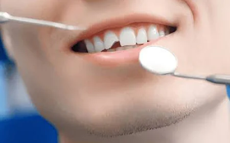 How Treatment of Fractured Teeth in Dubai Can Protect Your Oral Health