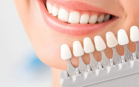 Everything You Need to Know About Zoom Teeth Whitening in Dubai
