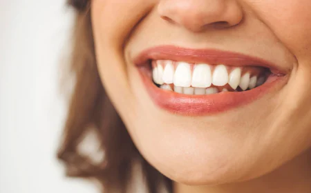 Teeth Whitening Dubai Best Whitening Techniques