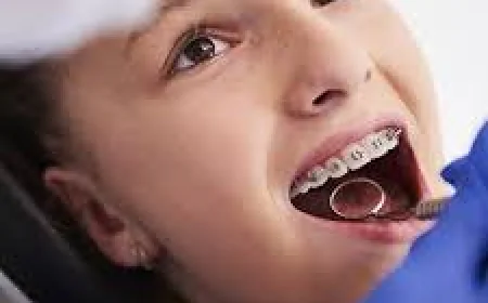 Clear Aligners vs Braces: Choosing Orthodontics in Dubai for Your Smile