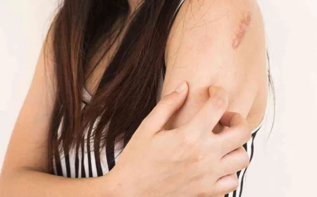 Can Keloid Treatment Deliver Remarkable Results for Skin Renewal?