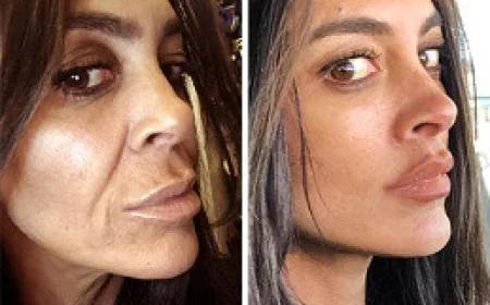 What Makes the Best Plastic Surgeon in Dubai Stand Out in Aesthetic Medicine