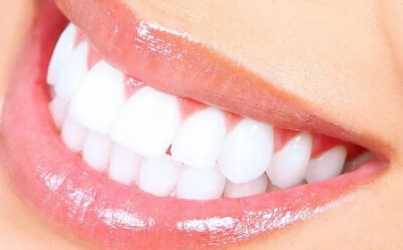 How Does Teeth Whitening Treatment Work?