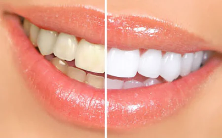 Porcelain Veneers Thousand Oaks: Expert Cosmetic Dentistry Near You