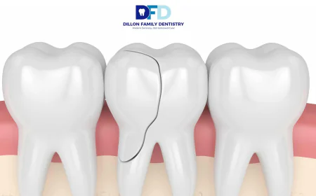 Cracked Tooth Emergency? What To Do | Dentist Bryn Mawr