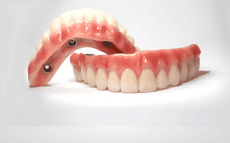 How Long Do Veneers in Dubai Typically Last?