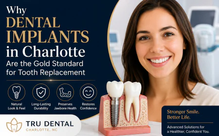 Why Dental Implants in Charlotte Are the Gold Standard for Tooth Replacement
