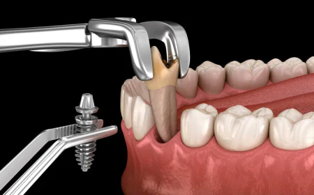 La Importancia de la Salud Bucal Infantil: Atención Especializada y Extracción Dental en Houston, TX