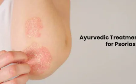 Ayurvedic Treatment for Psoriasis (Ekakushtha / Kitibha)
