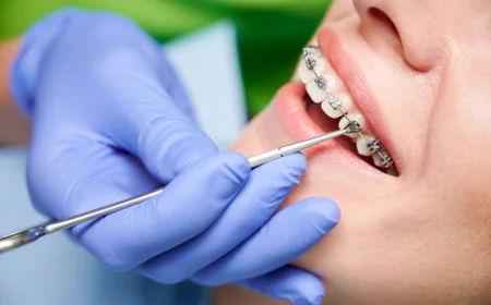 Orthodontic Treatment in NIBM Pune | Get a Perfect Smile with Expert Orthodontic Care