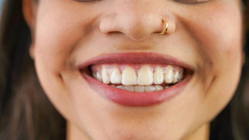 Why More People Are Choosing Teeth Aligners in Pakistan for a Straighter Smile