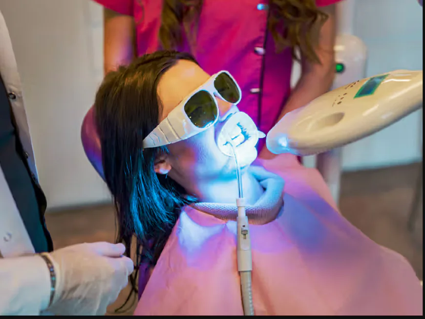 How Laser Teeth Whitening Works: A Complete Guide