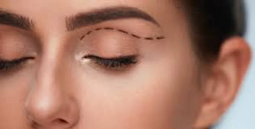 Chirurgie des Paupières à Paris : Rajeunir le Regard