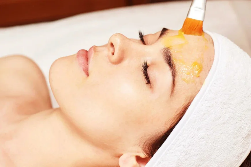 Chemical peels for treating acne-prone skin