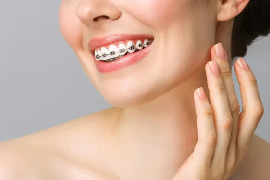 What Is the Procedure of Orthodontic Braces Treatment? Step-by-Step Guide