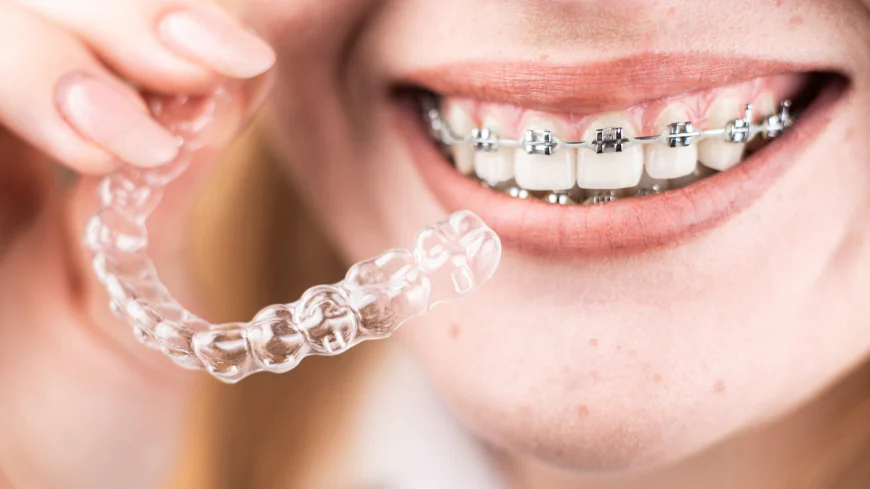 Orthodontic Treatment: Procedure, Benefits & What Patients Should Know
