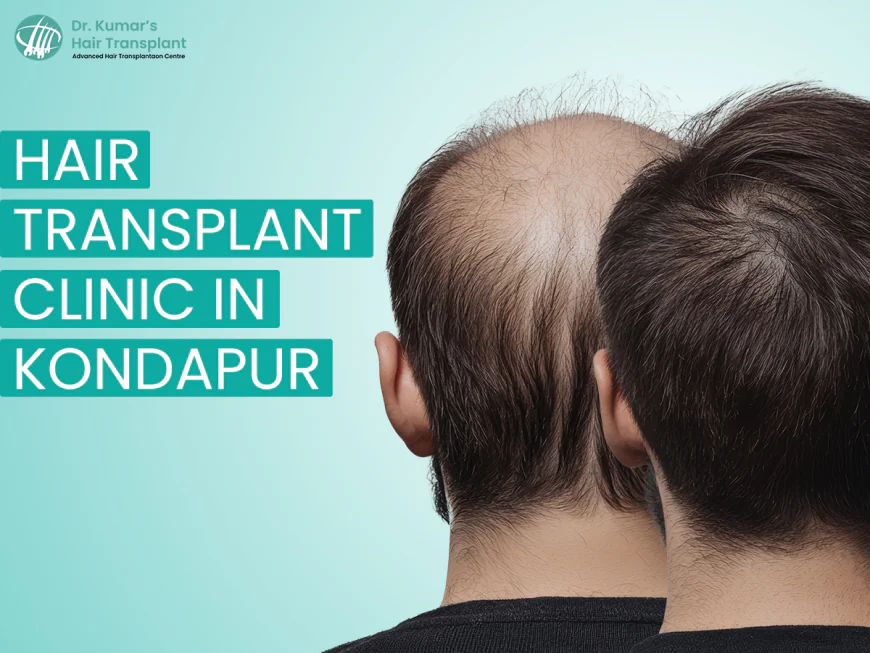 Hair Transplant in Kondapur: What Every Patient Should Know Before Deciding