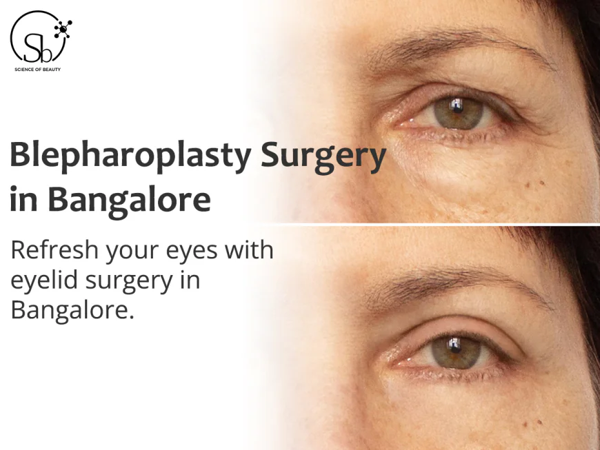 Can Blepharoplasty Make You Look Younger?