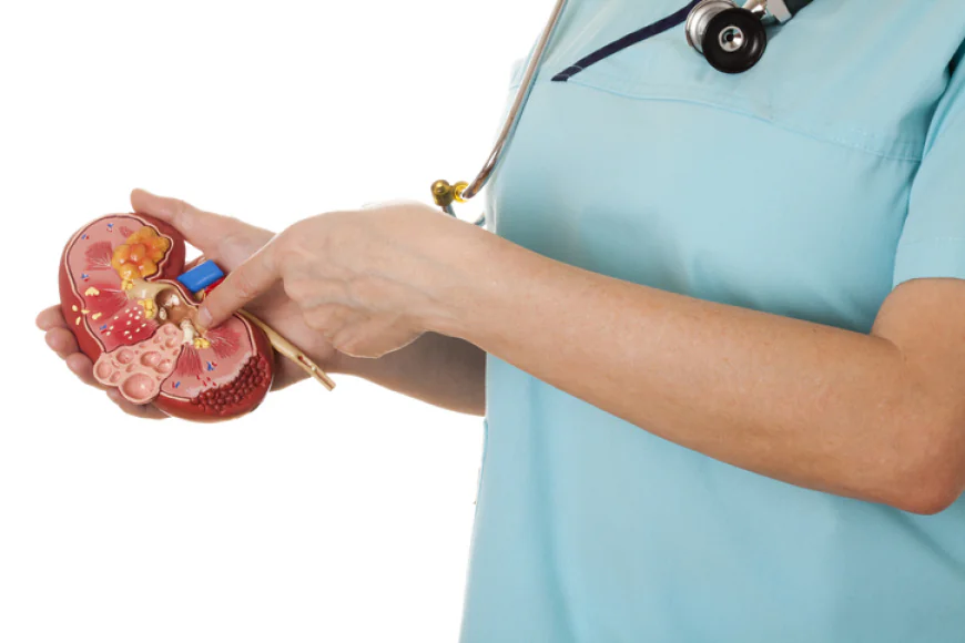 Understanding Kidney Stone Treatments: When to See a Doctor