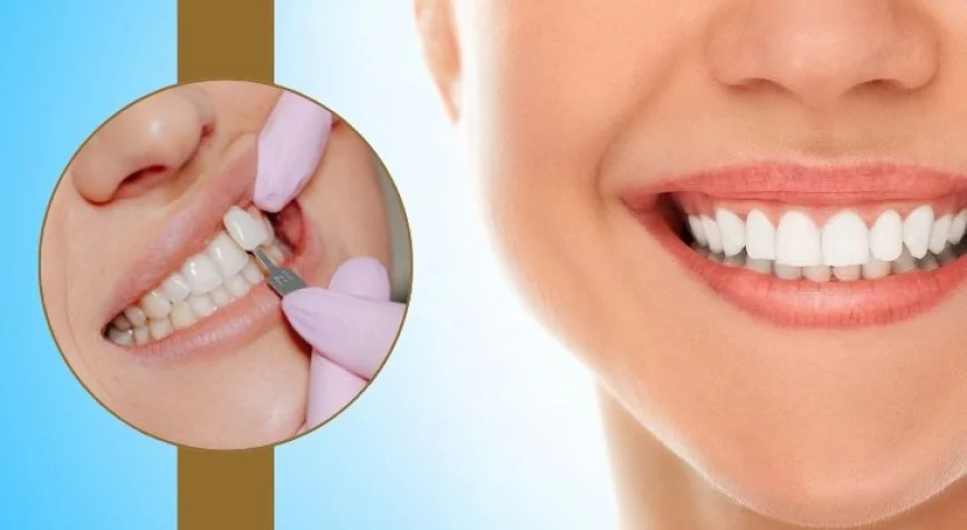 How to Choose the Right Cosmetic Dentist for Treatment