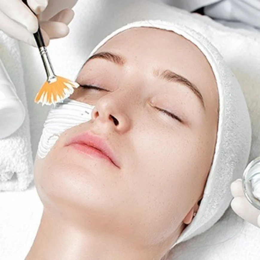 Chemical Skin Peel Treatment in Islamabad