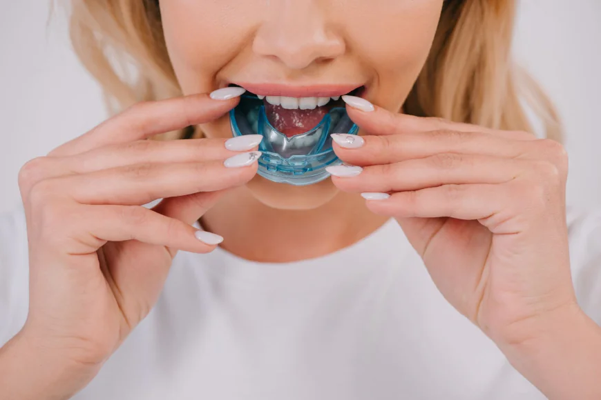 How Can Mouth Guards Help Protect Your Teeth?