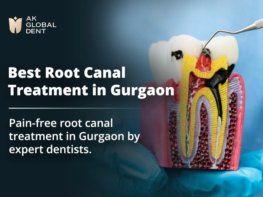 Get Pain-Free Root Canal Treatment at Gurgaon's Leading Dental Clinic
