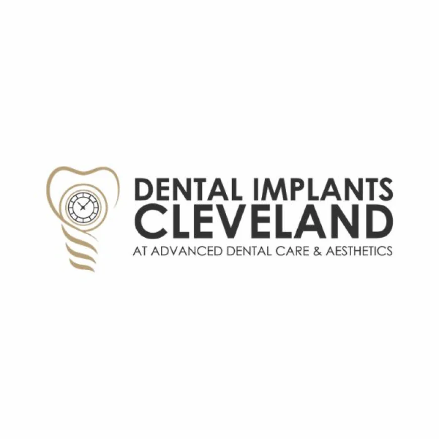 Restore Your Smile with a Trusted Dental Implant Dentist Cleveland OH